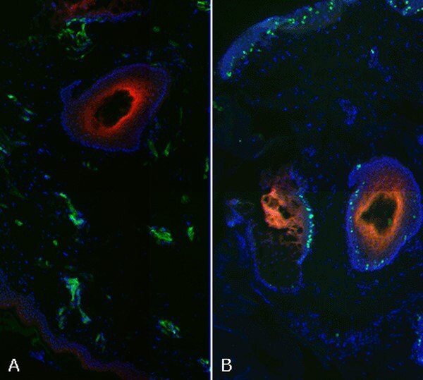 Hypoxia Detection Assays