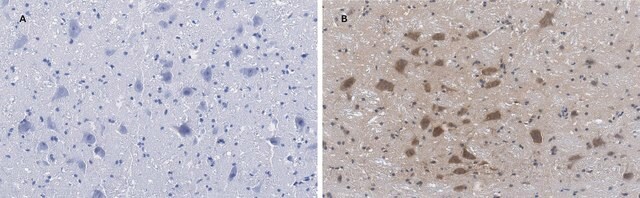 Anti-Choline Acetyltransferase (ChAT) Antibody, clone 2K16, ZooMAb&#174; Rabbit Monoclonal recombinant, expressed in HEK 293 cells