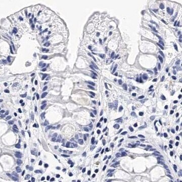 Anti-ITGA2B antibody produced in rabbit Prestige Antibodies&#174; Powered by Atlas Antibodies, affinity isolated antibody, buffered aqueous glycerol solution
