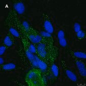 Anti-NMDAR2A Antibody, clone A12W, ZooMAb&#174; Rabbit Monoclonal recombinant, expressed in HEK 293 cells