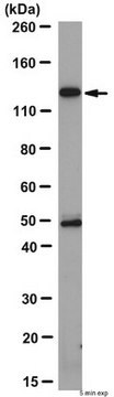 Anti-Pumilio-2 (PUM2) Antibody from rabbit, purified by affinity chromatography