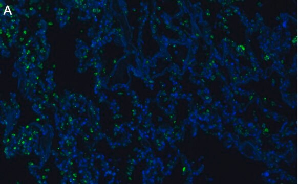 Anti-SFTPC Antibody, clone 3F18 ZooMAb&#174; Rabbit Monoclonal recombinant, expressed in HEK 293 cells
