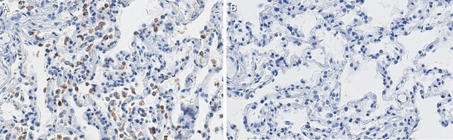 Anti-SFTPC Antibody, clone 3F18 ZooMAb&#174; Rabbit Monoclonal recombinant, expressed in HEK 293 cells