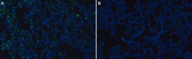 Anti-SFTPC Antibody, clone 3F18 ZooMAb&#174; Rabbit Monoclonal recombinant, expressed in HEK 293 cells