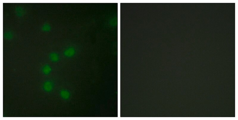 M-MLV Reverse Transcriptase Moloney Murine Leukemia Virus enzyme buffer for  cDNA synthesis 9068-38-6