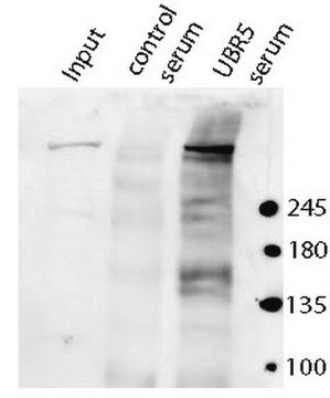 Anti-E3 ubiquitin-protein ligase (UBR5/EDD) serum, from rabbit