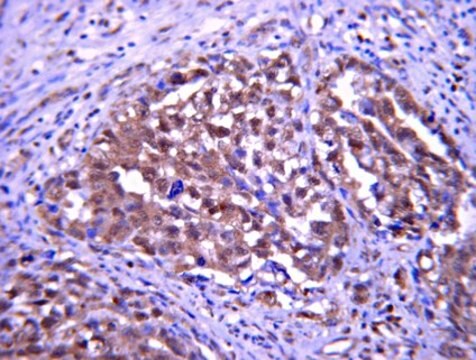 Anti-Pumilio-2 (PUM2) Antibody from rabbit, purified by affinity chromatography
