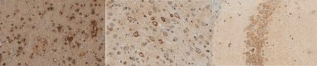 Anti-APP585C serum, from rabbit