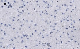 Anti-phospho-GluR1 (Ser831) Antibody, clone N453, ZooMAb&#174; Rabbit Monoclonal recombinant, expressed in HEK 293 cells