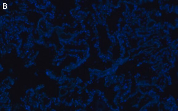 Anti-SFTPC Antibody, clone 3F18 ZooMAb&#174; Rabbit Monoclonal recombinant, expressed in HEK 293 cells