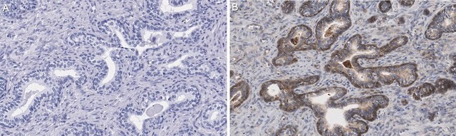 Anti-Integrin &#945;V&#946;5 Antibody, clone EM09902 , ZooMAb&#174; Rabbit Monoclonal recombinant, expressed in HEK 293 cells