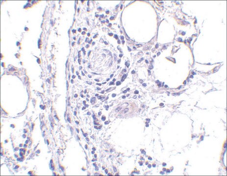 Anti-Brain lipid binding protein Antibody from rabbit, purified by affinity  chromatography