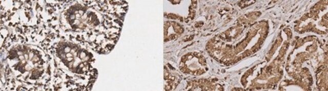 Anti-NKCC1/2 Antibody, clone T4 clone T4, from mouse