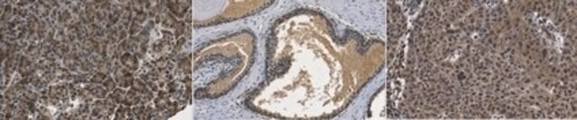 Anti-MBD5 from rabbit, purified by affinity chromatography