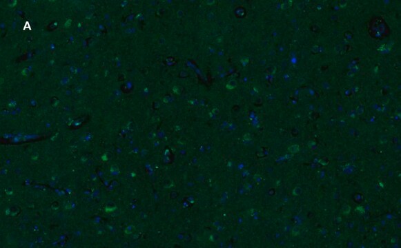 Anti-GluR2 Antibody, clone 1K4, ZooMAb&#174; Rabbit Monoclonal recombinant, expressed in HEK 293 cells
