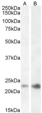 Anti-CAV3 (N-terminal) antibody produced in goat affinity isolated antibody, buffered aqueous solution