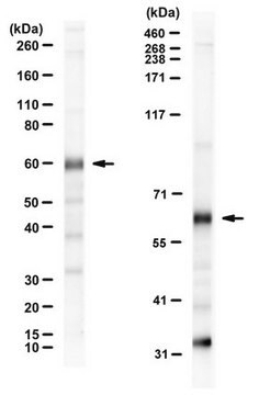 Anti-Wilms Tumor (WT33) from rabbit, purified by affinity chromatography