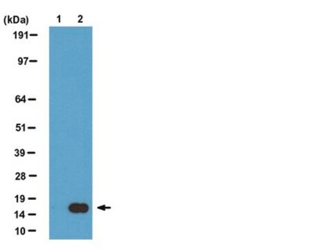 ChIPAb+ acetil-istone H3 (Lys27) - anticorpo per ChIP convalidato e set di primer clone CMA309, from mouse
