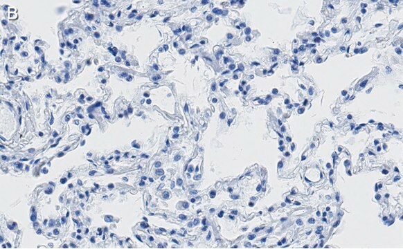Anti-SFTPC Antibody, clone 3F18 ZooMAb&#174; Rabbit Monoclonal recombinant, expressed in HEK 293 cells
